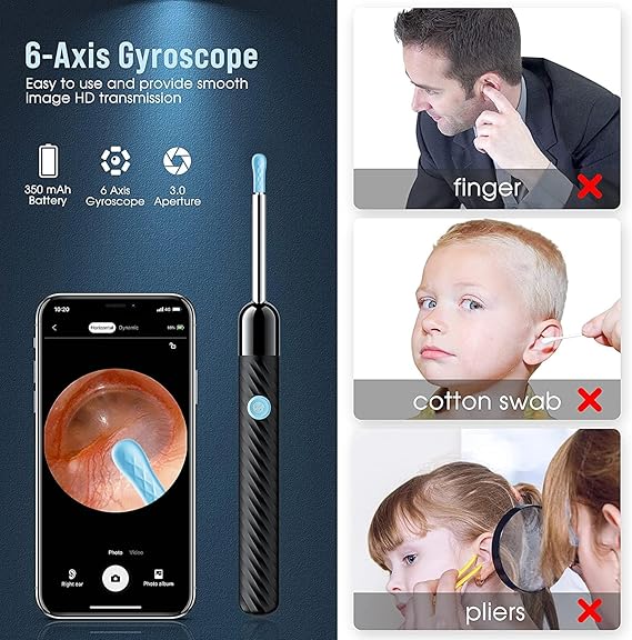 EarWiz - Smart Ear Cleaner
