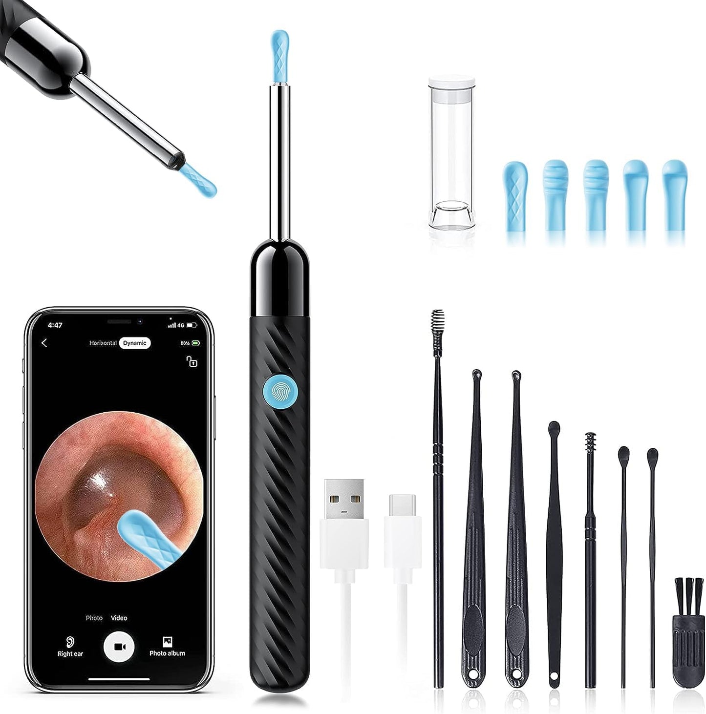 EarWiz - Smart Ear Cleaner