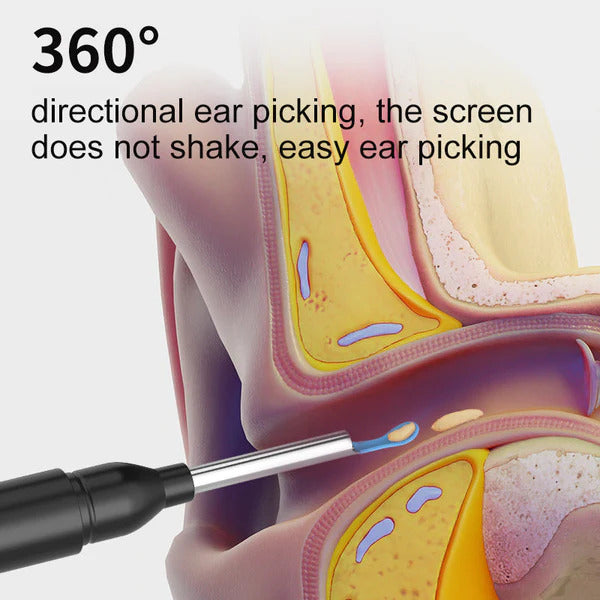 EarWiz - Smart Ear Cleaner